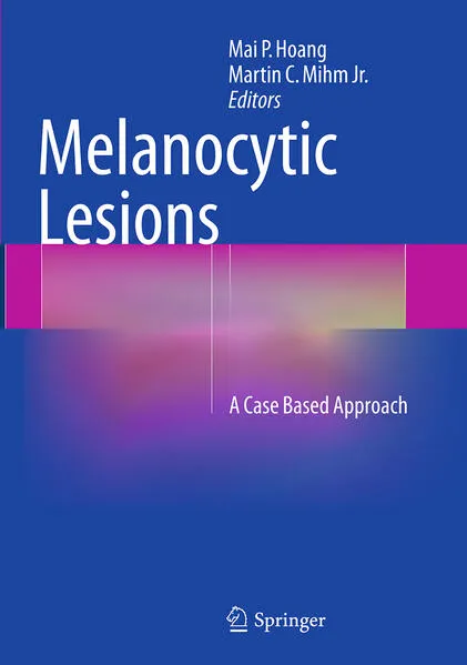 Melanocytic Lesions