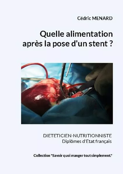 Cover: Quelle alimentation après la pose d'un stent ?