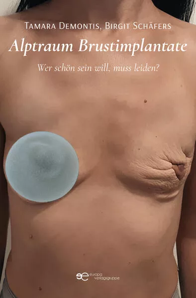 ALPTRAUM BRUSTIMPLANTATE